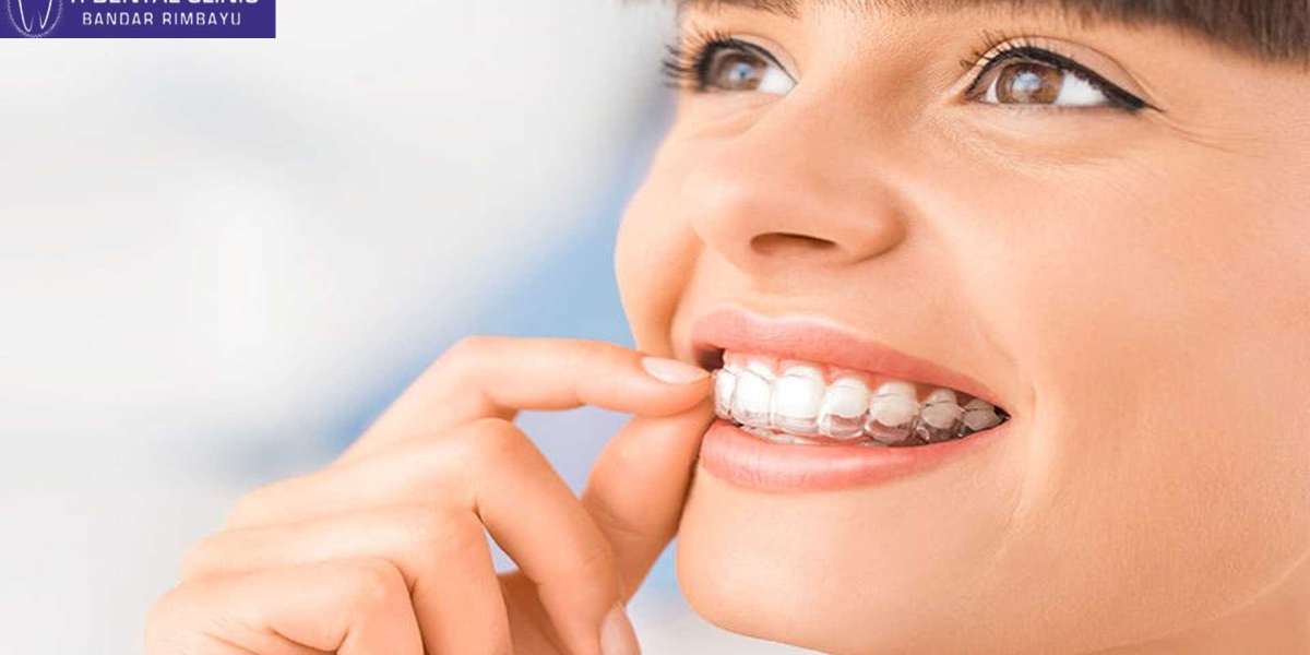 The Latest Innovations in Dental Implants and Braces for Kids
