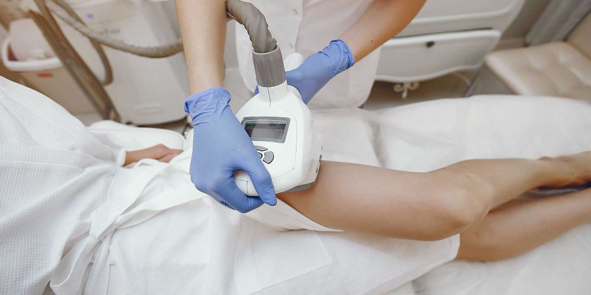 Diolaze Laser Hair Removal for Smooth Skin